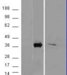 Anti-AKR1B10 antibody, C-term used in Western Blot (WB). GTX88827