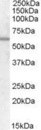 Anti-Frizzled 7 antibody, C-term used in Western Blot (WB). GTX88831