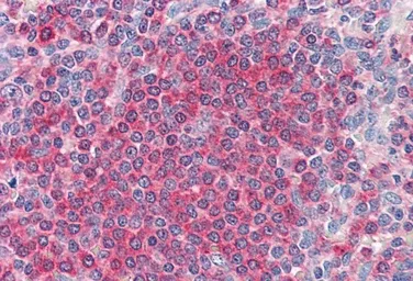 Anti-Frizzled 7 antibody, C-term used in IHC (Paraffin sections) (IHC-P). GTX88831