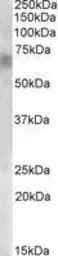 Anti-RPE65 antibody, Internal used in Western Blot (WB). GTX88833