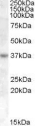 Anti-RASSF7 antibody, Internal used in Western Blot (WB). GTX88839