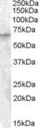 Anti-IGF2BP2 antibody, C-term used in Western Blot (WB). GTX88840