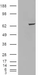 Anti-IGF2BP2 antibody, C-term used in Western Blot (WB). GTX88840