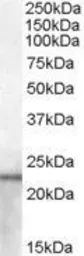 Anti-Lipocalin-2 antibody, Internal used in Western Blot (WB). GTX88841