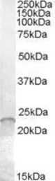Anti-ASF1A antibody, Internal used in Western Blot (WB). GTX88842