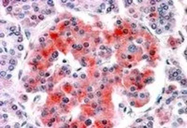 Anti-Kir6.2 antibody, Internal (near the N-term) used in IHC (Paraffin sections) (IHC-P). GTX88845