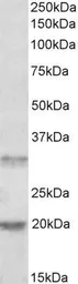 Anti-ASRGL1 antibody, Internal used in Western Blot (WB). GTX88848