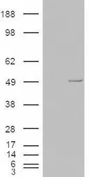 Anti-Casein Kinase 1 epsilon antibody, C-term used in Western Blot (WB). GTX88851