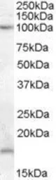 Anti-TEB4 / MARCH-VI (aa 701 to 712) antibody, Internal used in Western Blot (WB). GTX88852