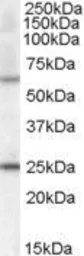 Anti-COL4A3BP (aa662-672) antibody, Internal used in Western Blot (WB). GTX88855