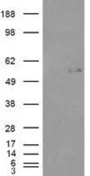 Anti-GCNT3 (aa 273 to 284) antibody, Internal used in Western Blot (WB). GTX88861