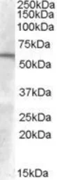 Anti-GCNT3 antibody, Internal used in Western Blot (WB). GTX88863