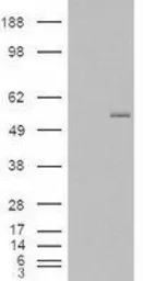 Anti-GCNT3 antibody, Internal used in Western Blot (WB). GTX88863