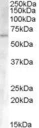 Anti-Activin Receptor Type IA antibody, Internal used in Western Blot (WB). GTX88867