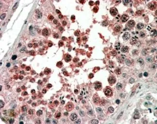 Anti-Activin Receptor Type IA antibody, Internal used in IHC (Paraffin sections) (IHC-P). GTX88867