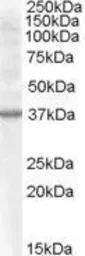 Anti-Renalase (aa 134 to 147) antibody, Internal used in Western Blot (WB). GTX88868
