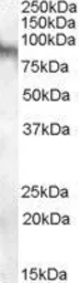 Anti-Neuroligin 3 antibody, Internal used in Western Blot (WB). GTX88872