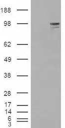 Anti-Neuroligin 3 antibody, Internal used in Western Blot (WB). GTX88872