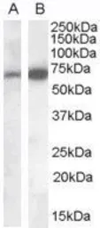 Anti-CADM4 antibody, C-term used in Western Blot (WB). GTX88883