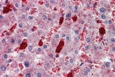 Anti-CADM4 antibody, C-term used in IHC (Paraffin sections) (IHC-P). GTX88883
