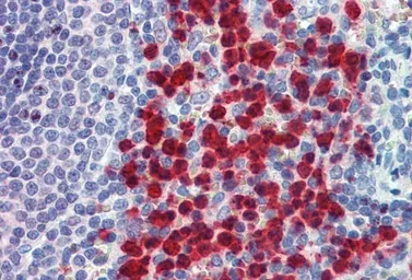 Anti-CADM4 antibody, C-term used in IHC (Paraffin sections) (IHC-P). GTX88883