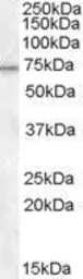 Anti-MEPCE antibody, Internal used in Western Blot (WB). GTX88885