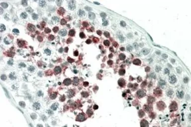 Anti-MEPCE antibody, Internal used in IHC (Paraffin sections) (IHC-P). GTX88885