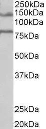 Anti-EBPL41L5 antibody, Internal used in Western Blot (WB). GTX88887