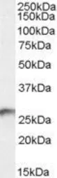 Anti-BDH2 (aa 60 to 71) antibody, Internal used in Western Blot (WB). GTX88892