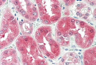 Anti-BDH2 (aa 60 to 71) antibody, Internal used in IHC (Paraffin sections) (IHC-P). GTX88892