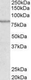 Anti-ABCB5 antibody, Internal used in Western Blot (WB). GTX88894