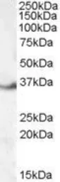 Anti-LASP1 antibody, Internal used in Western Blot (WB). GTX88898