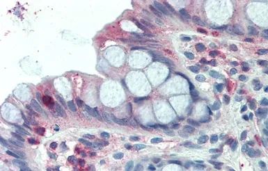 Anti-LASP1 antibody, Internal used in IHC (Paraffin sections) (IHC-P). GTX88898