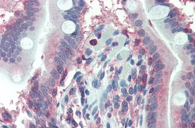 Anti-LASP1 antibody, Internal used in IHC (Paraffin sections) (IHC-P). GTX88898