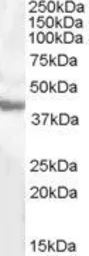 Anti-GOT1 (aa 22-35) antibody, Internal used in Western Blot (WB). GTX88903