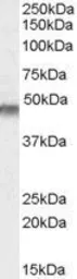 Anti-Kir6.2 antibody, Internal (near the N-term) used in Western Blot (WB). GTX88908