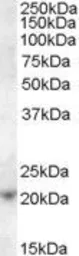 Anti-ASF1A antibody, C-term used in Western Blot (WB). GTX88909