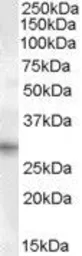 Anti-PRRX1 antibody, Internal used in Western Blot (WB). GTX88910