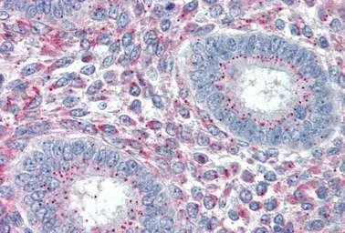 Anti-PRRX1 antibody, Internal used in IHC (Paraffin sections) (IHC-P). GTX88910