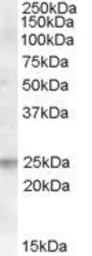 Anti-FAIM1 antibody, Internal used in Western Blot (WB). GTX88911