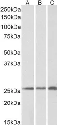 Anti-CSRP2 antibody, Internal used in Western Blot (WB). GTX88912