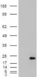 Anti-CSRP2 antibody, Internal used in Western Blot (WB). GTX88912
