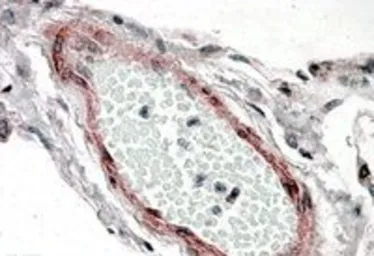 Anti-CSRP2 antibody, Internal used in IHC (Paraffin sections) (IHC-P). GTX88912