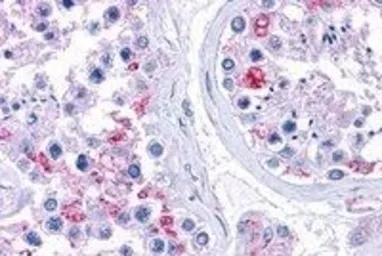 Anti-RPL22 antibody, C-term used in IHC (Paraffin sections) (IHC-P). GTX88916