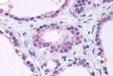 Anti-RPL22 antibody, C-term used in IHC (Paraffin sections) (IHC-P). GTX88916