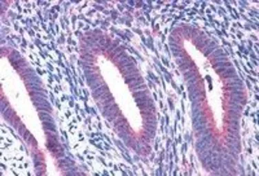 Anti-RPL22 antibody, C-term used in IHC (Paraffin sections) (IHC-P). GTX88916