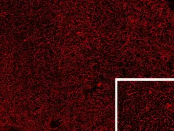 Anti-Proenkephalin antibody, Internal used in IHC (Frozen sections) (IHC-Fr). GTX88917