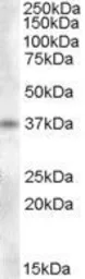 Anti-Proenkephalin antibody, Internal used in Western Blot (WB). GTX88917