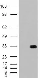 Anti-HADH antibody, Internal used in Western Blot (WB). GTX88923