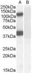 Anti-EPB41L2 (aa 593 to 604) antibody, Internal used in Western Blot (WB). GTX88926